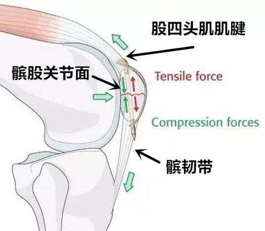 股四头肌肌腱断裂修复术后康复训练计划(完整篇)