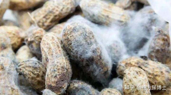 女子接触霉变玉米后肺部长满黄曲霉菌什么是黄曲霉毒素有哪些危害日常