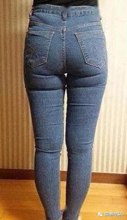 这样的腿算是x型腿吗应该如何矫正