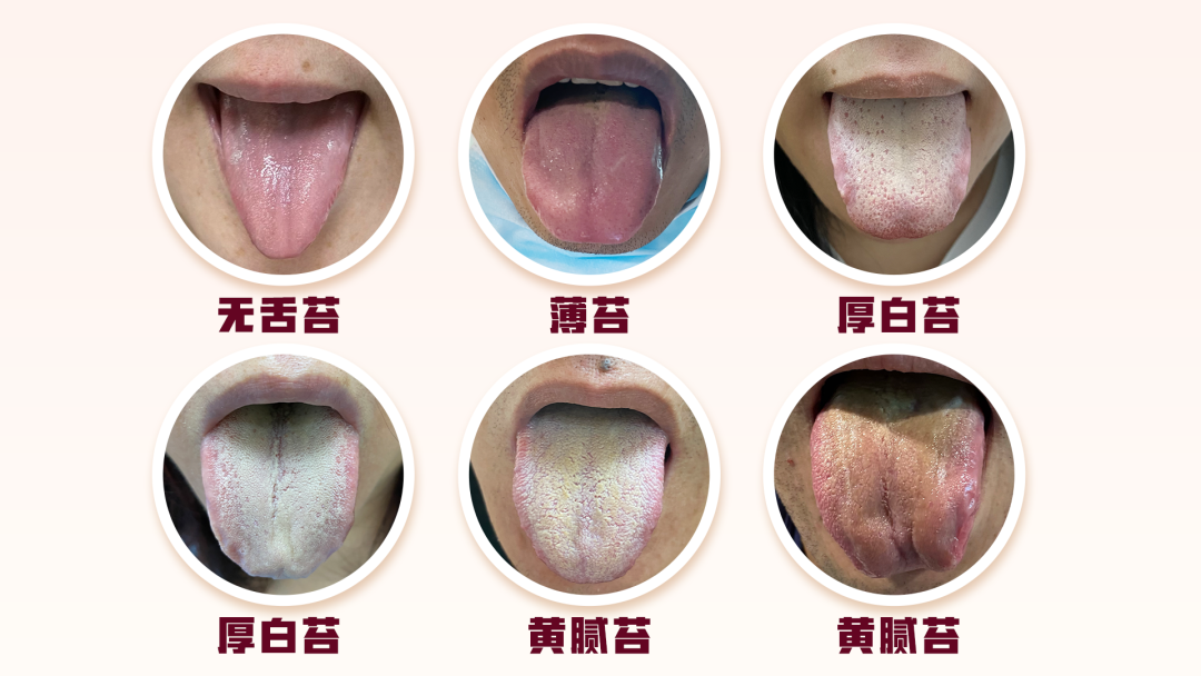 3分钟学会看舌象,提前预知身体健康状况 - 知乎