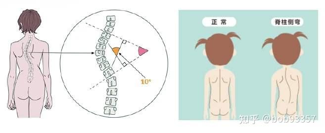 自頸部到臀部呈