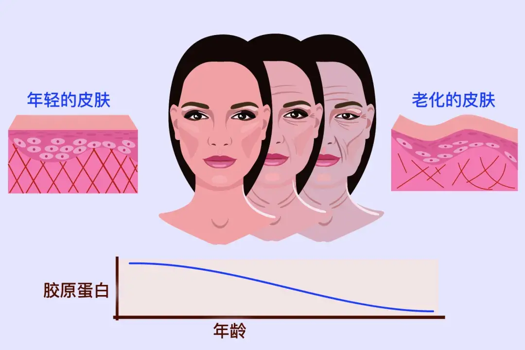 脸上胶原蛋白流失了该怎样补充