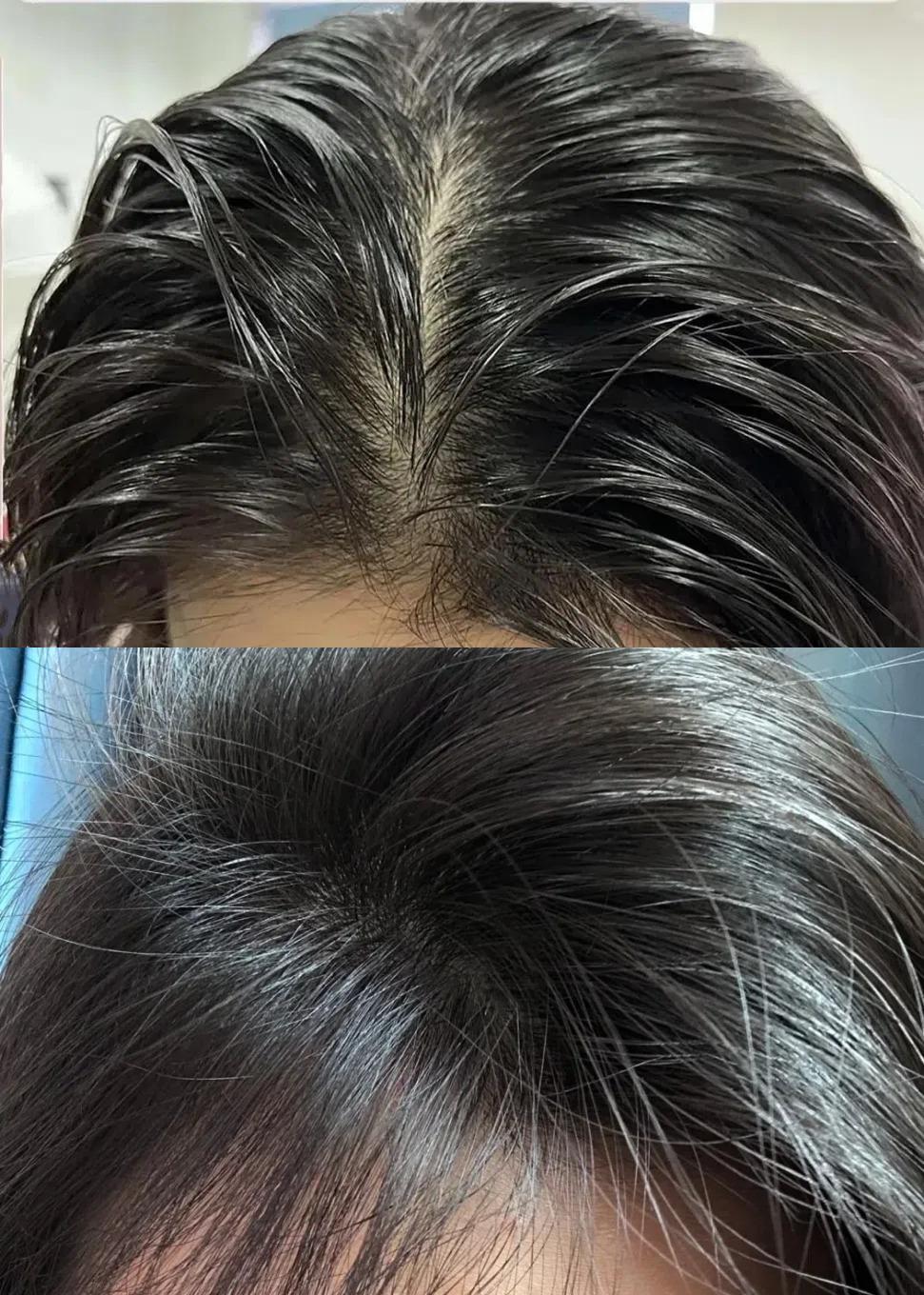 一个星期之后,能明显感觉到头发出油速度减慢了很多,就算是三天不洗