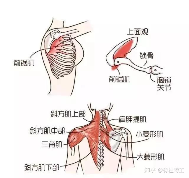 所谓蝴蝶背不过是翼状肩形成原因自测方法矫正训练