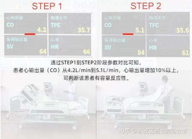 被动抬腿试验 (passive leg raising,PLR) - 知乎