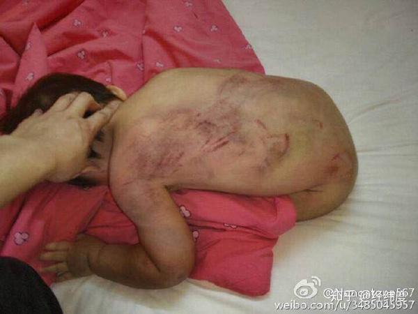 从十个虐童事件的处理结果看国内儿童保护制度的缺失家庭才是虐童重