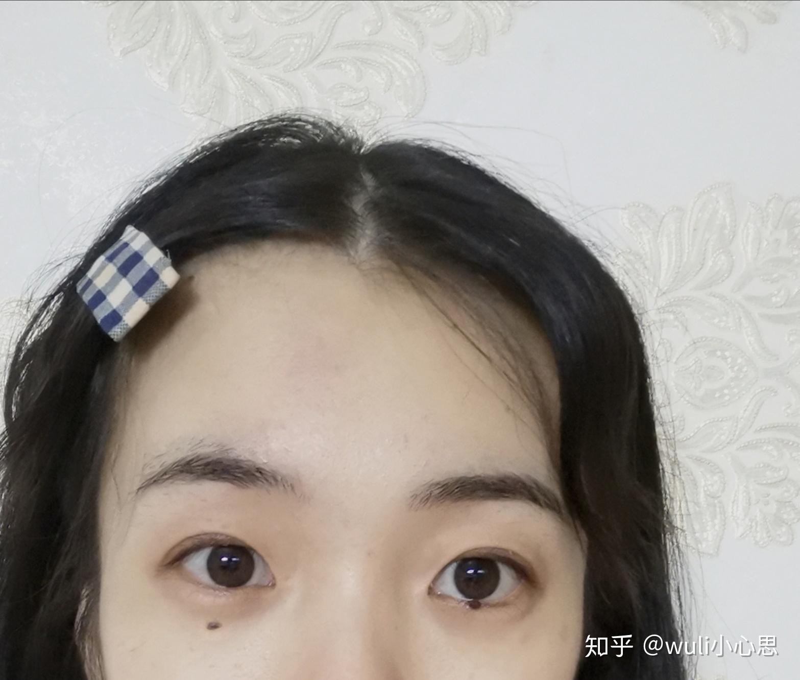 你怎么看待眼下痣