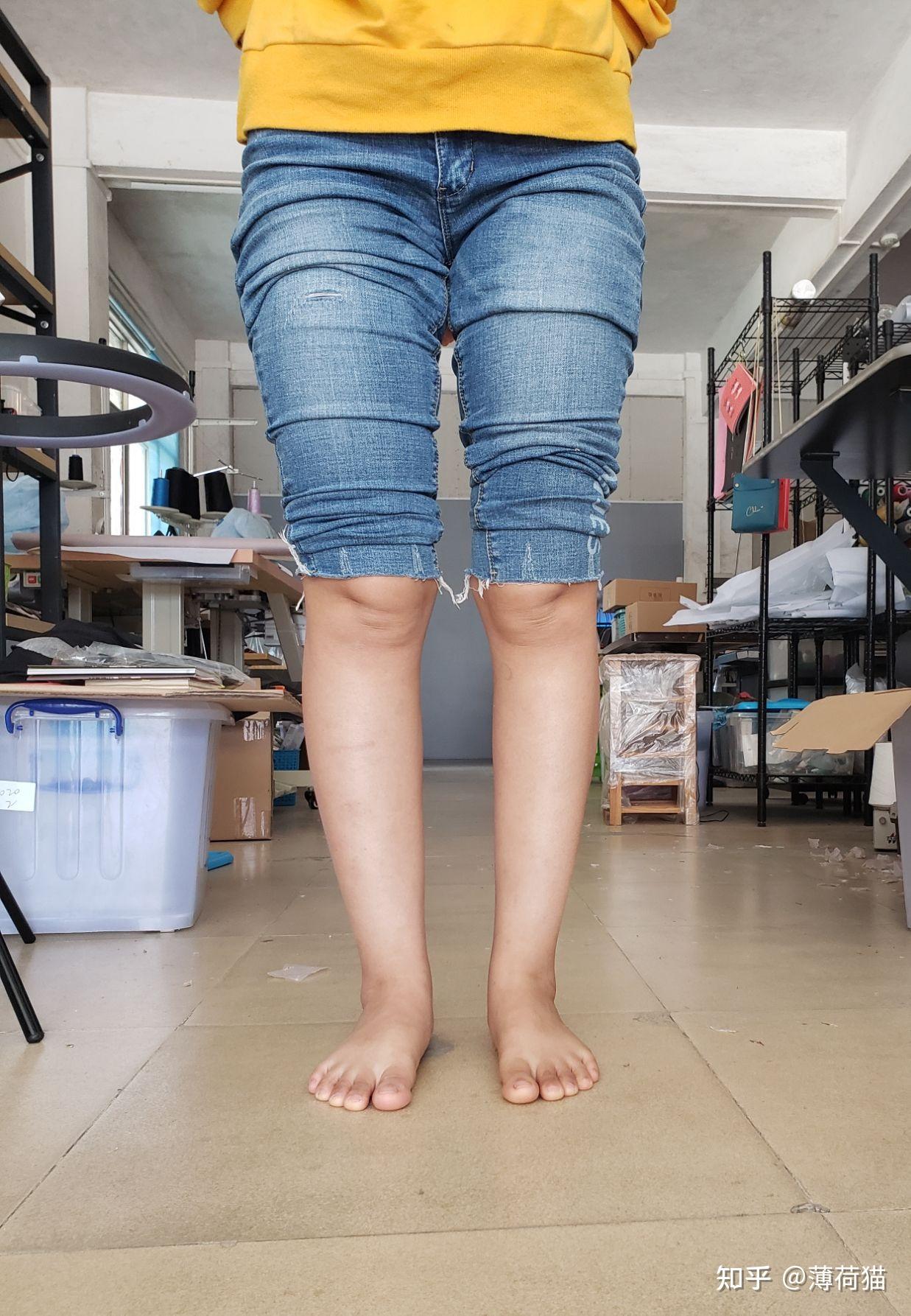 膝盖脚踝损伤如何运动康复锻炼