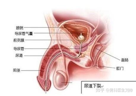 男性生殖系统损伤 尿道损伤