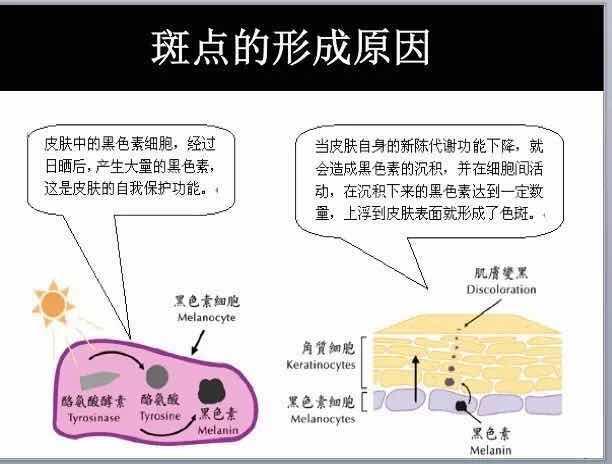 美白是一道算术题健康美白