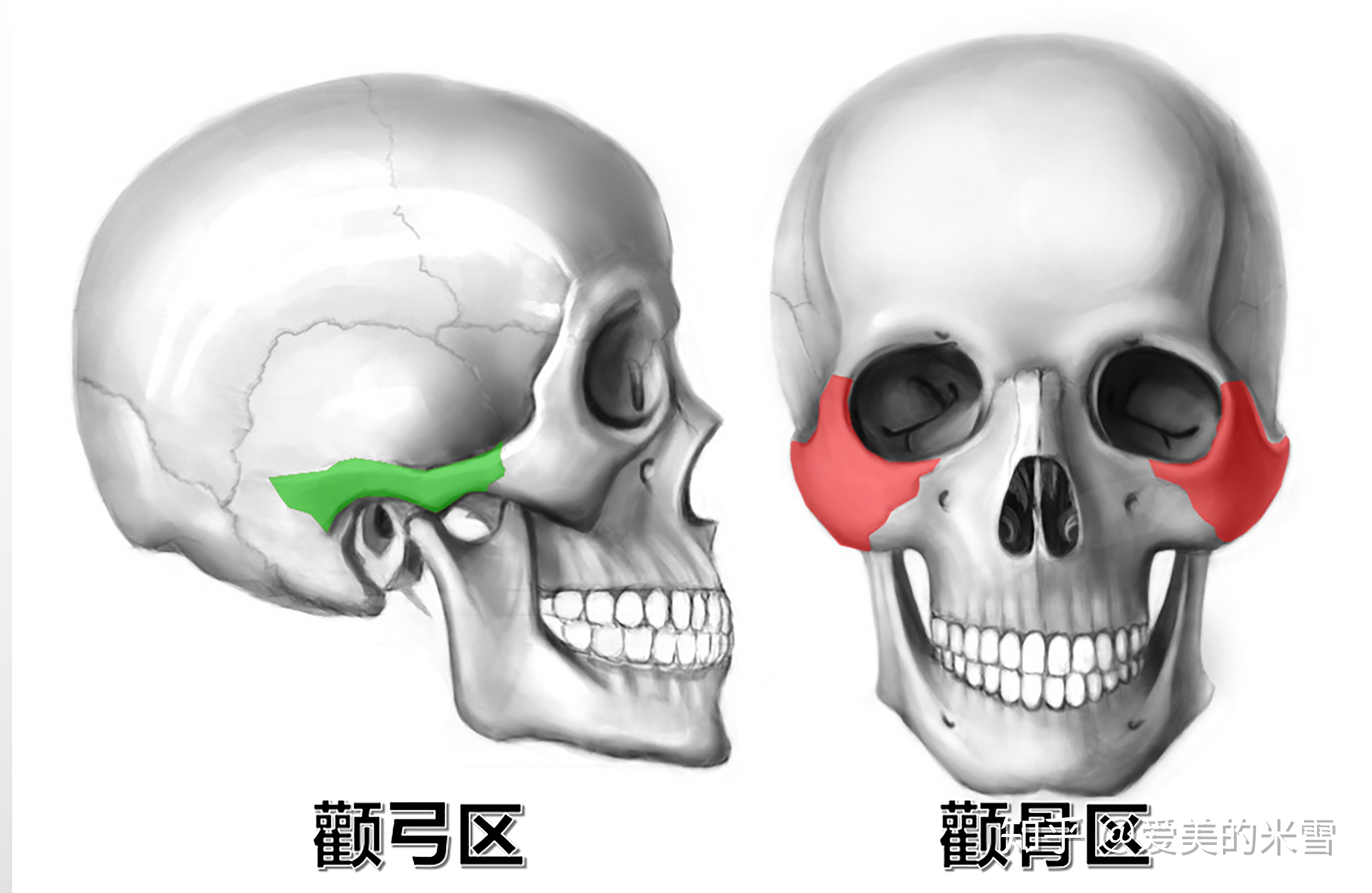 磨颧骨到底会不会下垂呀? - 知乎