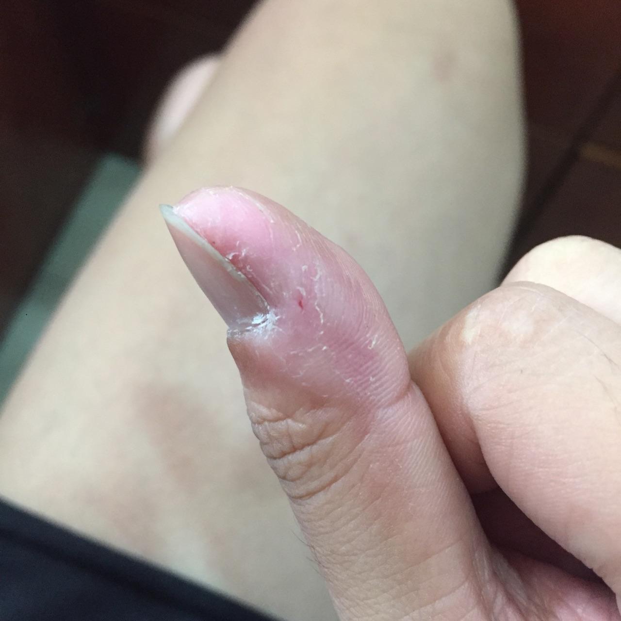 克制不住的抠手指头是心理问题吗?