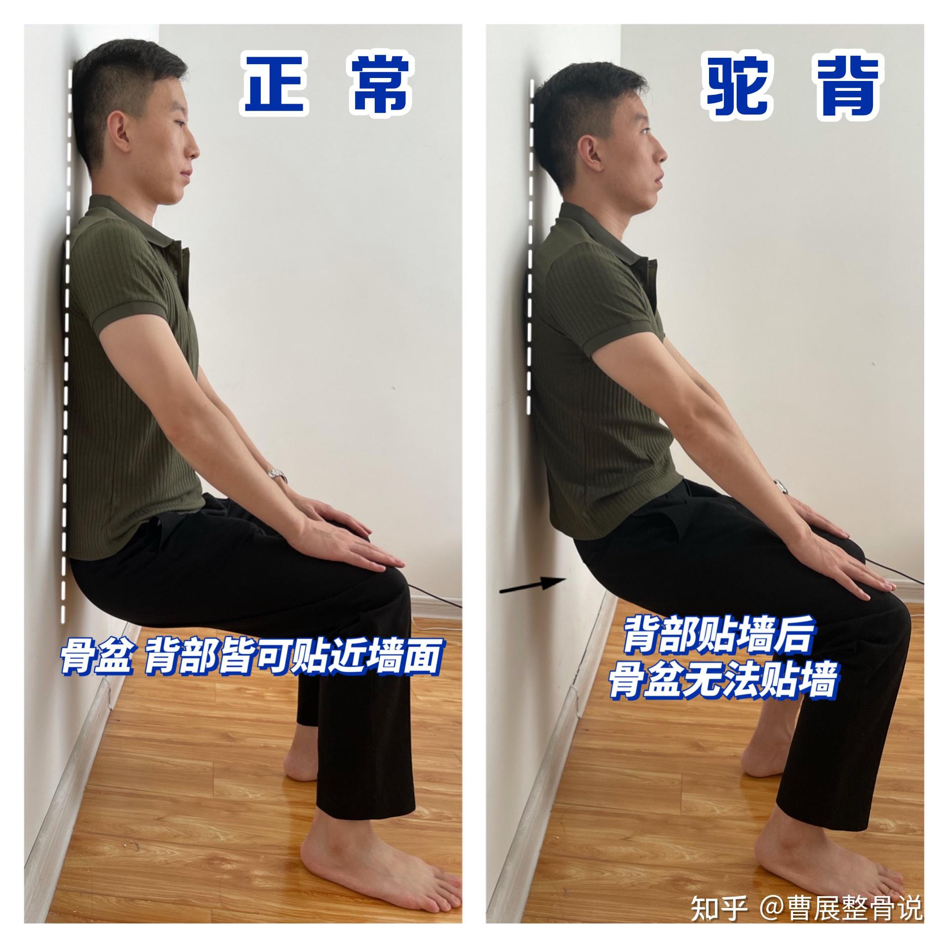 怎么矫正含胸驼背 - 知乎