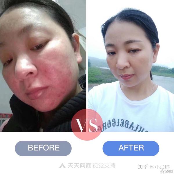 forever产品的见证