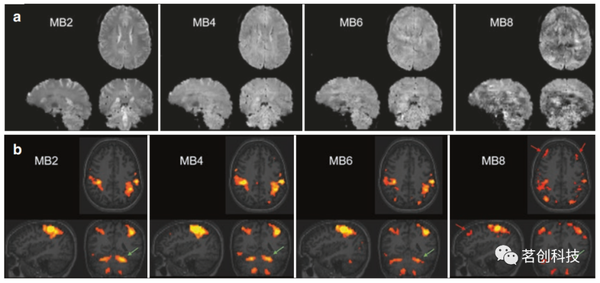 BOLD fMRI和DTI：伪影、技巧和诀窍 - 知乎