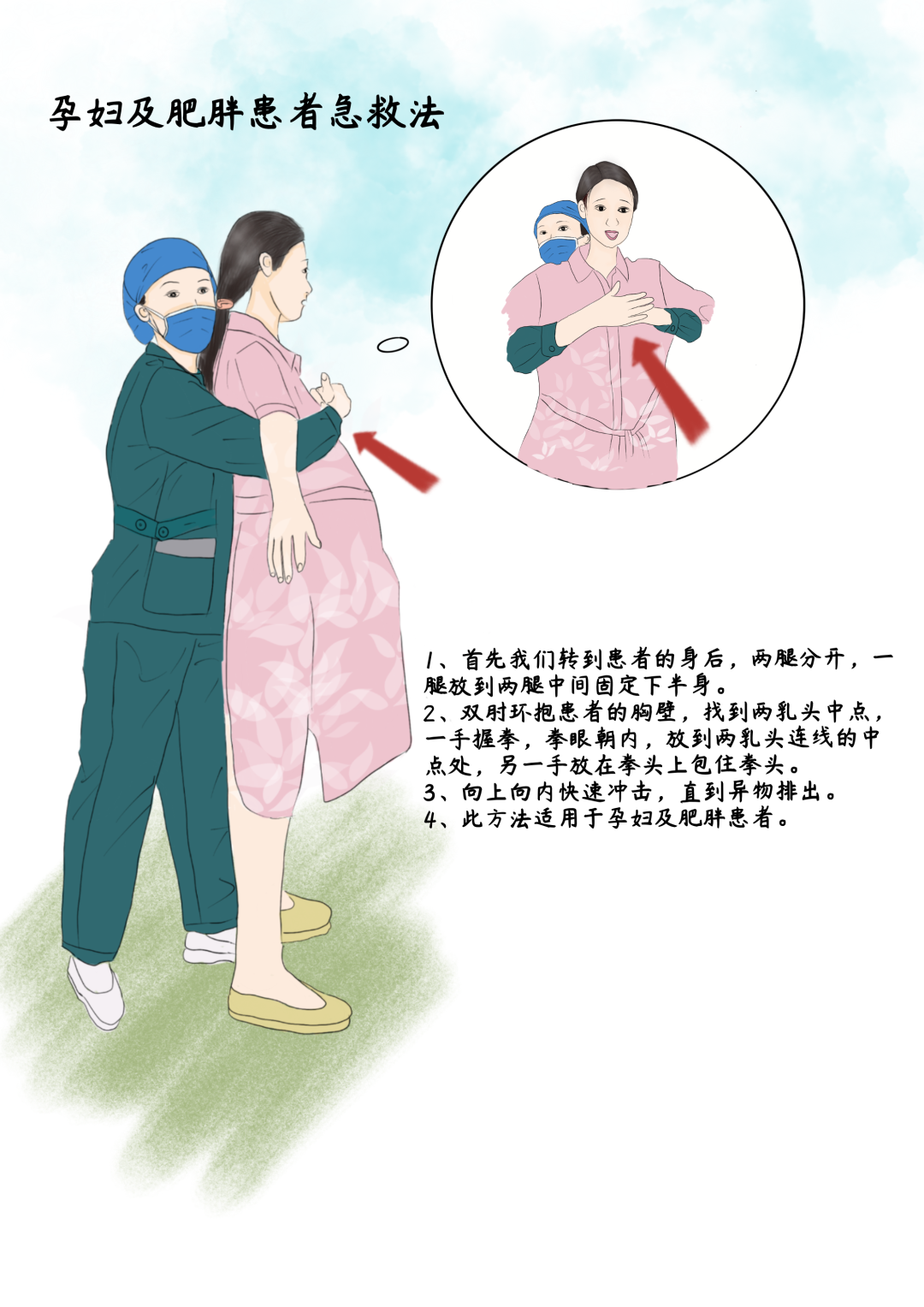 异物卡喉有哪些急救措施