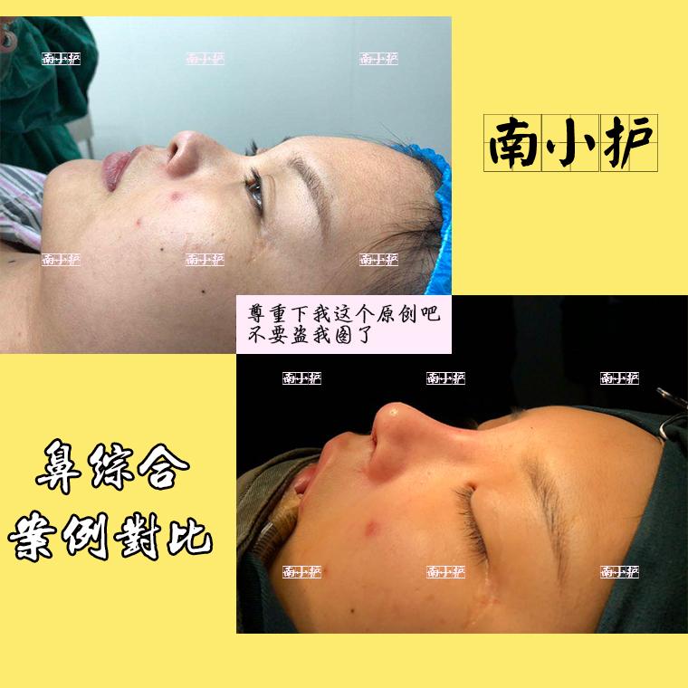 v2-6fe9cdb6e5808adbff087cf3a729126b_1440w.jpg?source=172ae18b