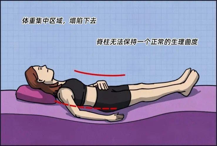 科普｜腰椎不好的病人，到底能不能睡硬板床？ - 知乎