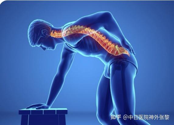 脊髓损伤后疼痛在那种情况下脊髓电刺激疗法被认为是更好的治疗选择