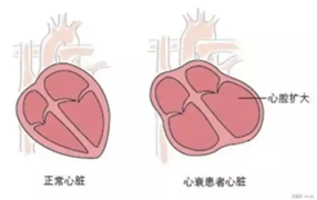 心脏组织常见病理变化 - 知乎