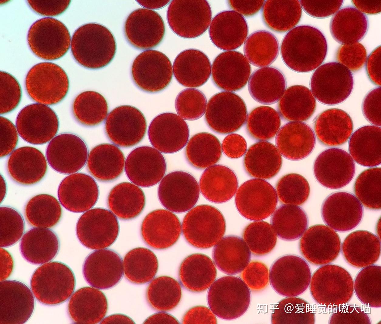 【糖鞘脂类】呃,这个比较复杂,简单说来,鞘脂类分为糖鞘脂和鞘磷脂.