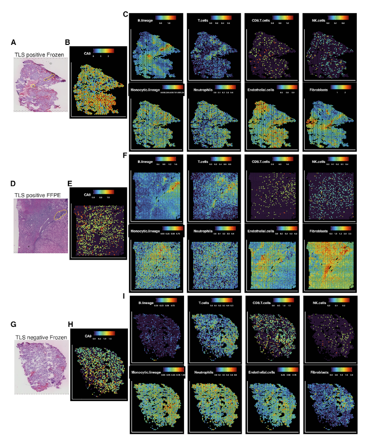 全球首篇10x Genomics Visium FFPE空间转录组测序文章重磅来袭 - 知乎
