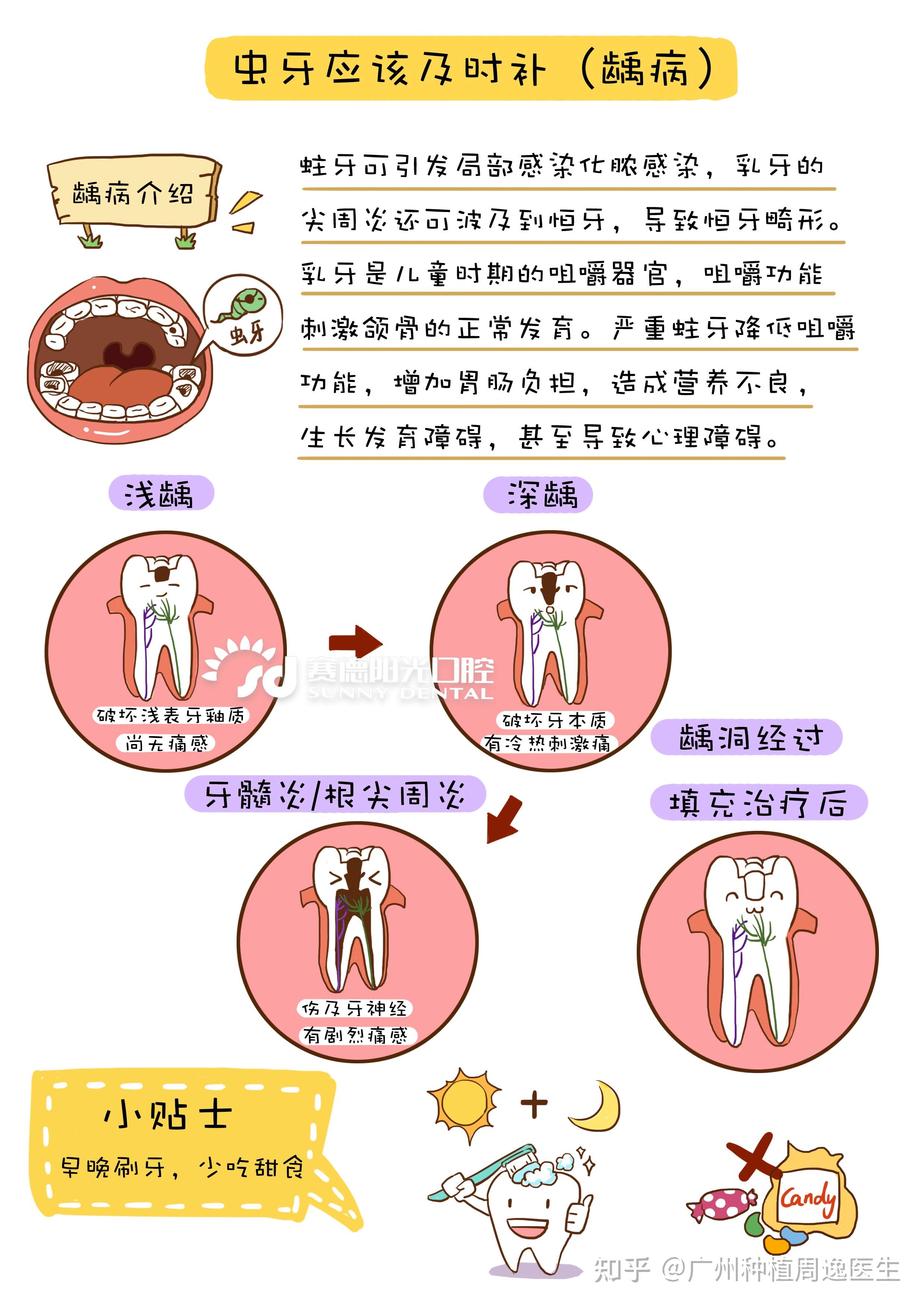 牙有蛀蟲怎麼辦