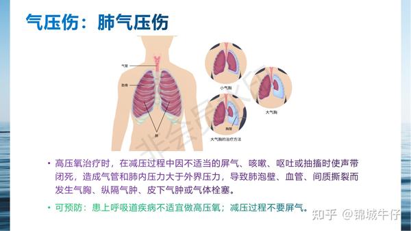 高压氧治疗的副作用和禁忌症 知乎
