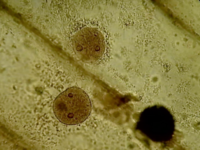 碘液遇细胞核为什么变成红褐色