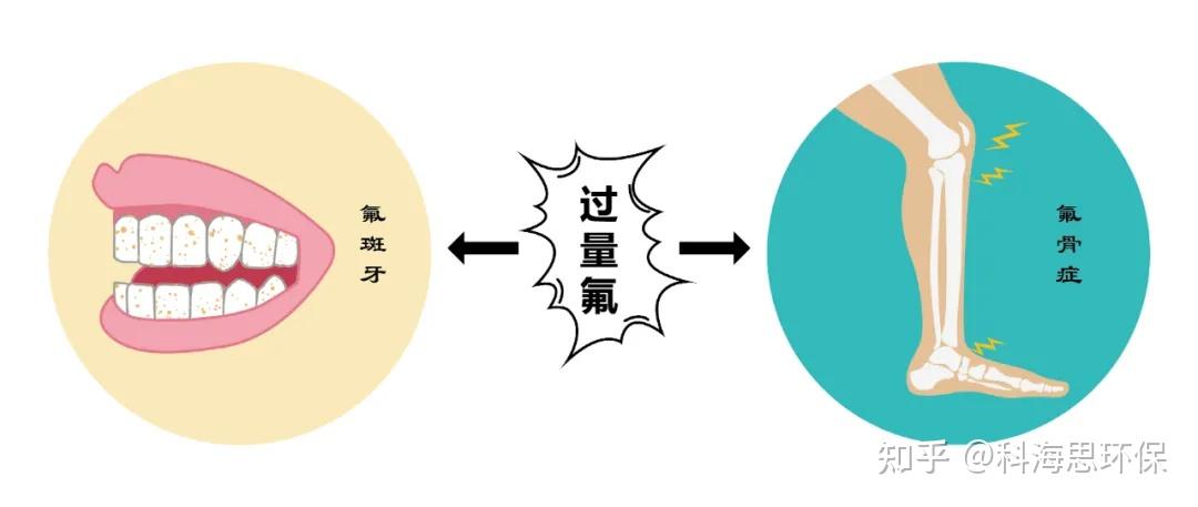 除氟可提高饮用水安全性,预防氟中毒,减少氟斑牙和氟骨症等疾病 - 知乎