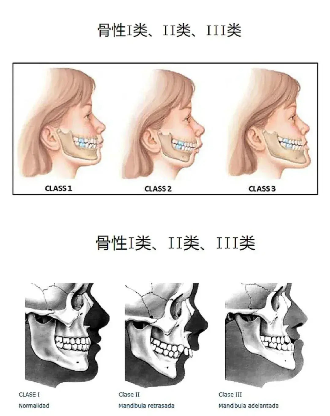 情况不严重建议千万别碰正颌手术,但如果你的颌面问题很大,那还是看完这篇完整攻略尽早考虑正颌 - 知乎
