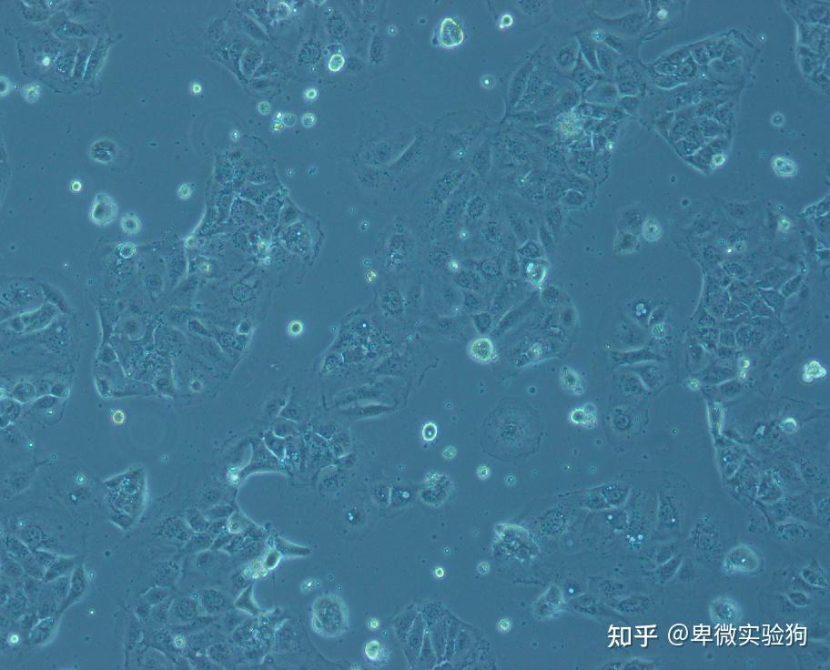养的caco-2细胞,请问图片上画的是微绒毛吗? - 知乎