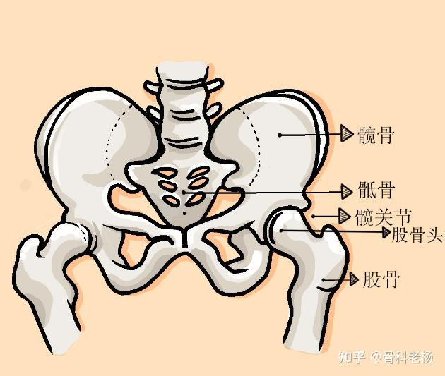 有没有什么适合股骨头坏死的腿部锻炼