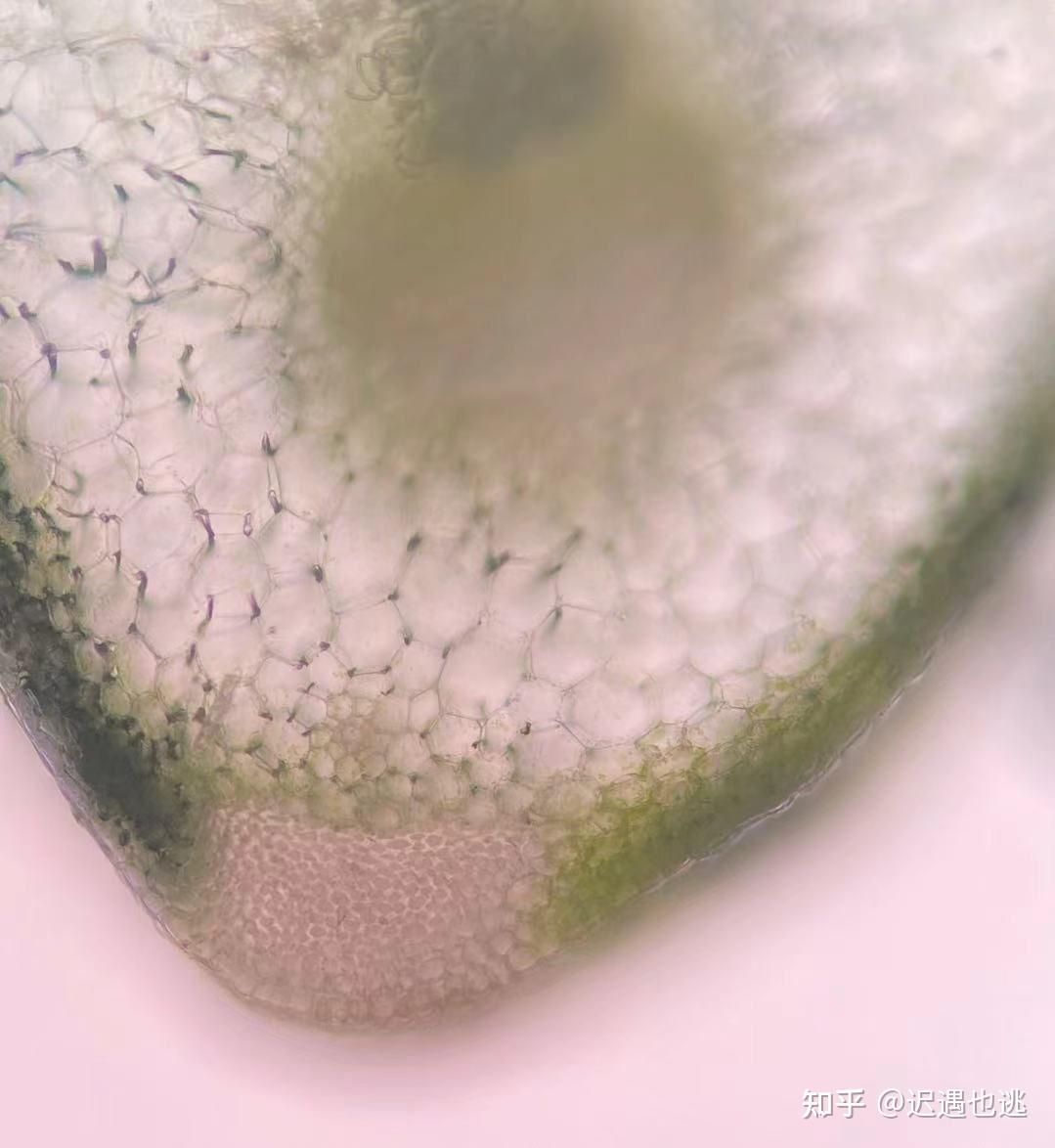 谁知道厚角组织细胞长什么样可以是细胞观察图最好是手绘图谢谢大家