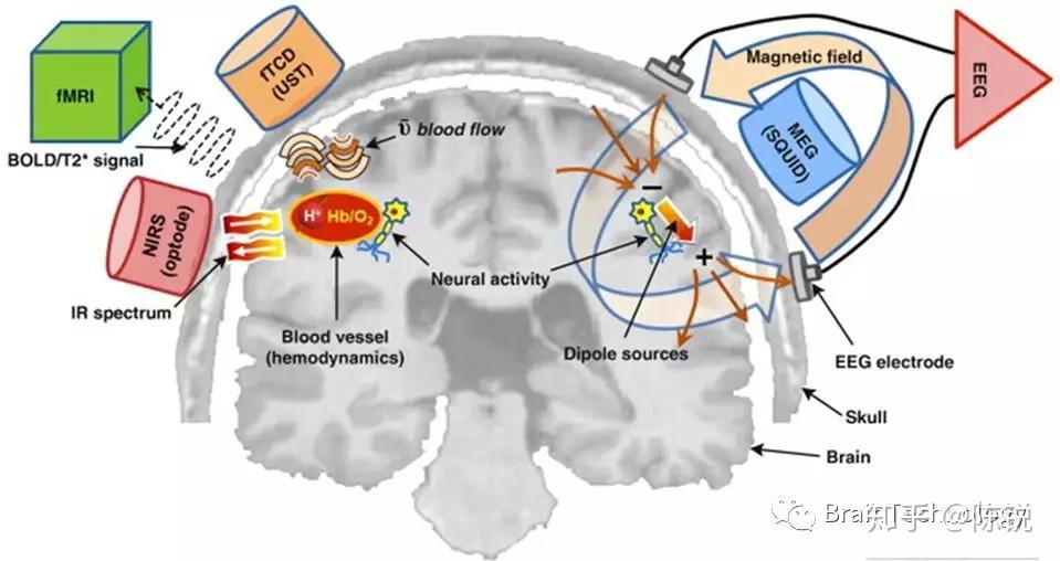 eeg-vs-mri-vs-fmri-vs-fnirs