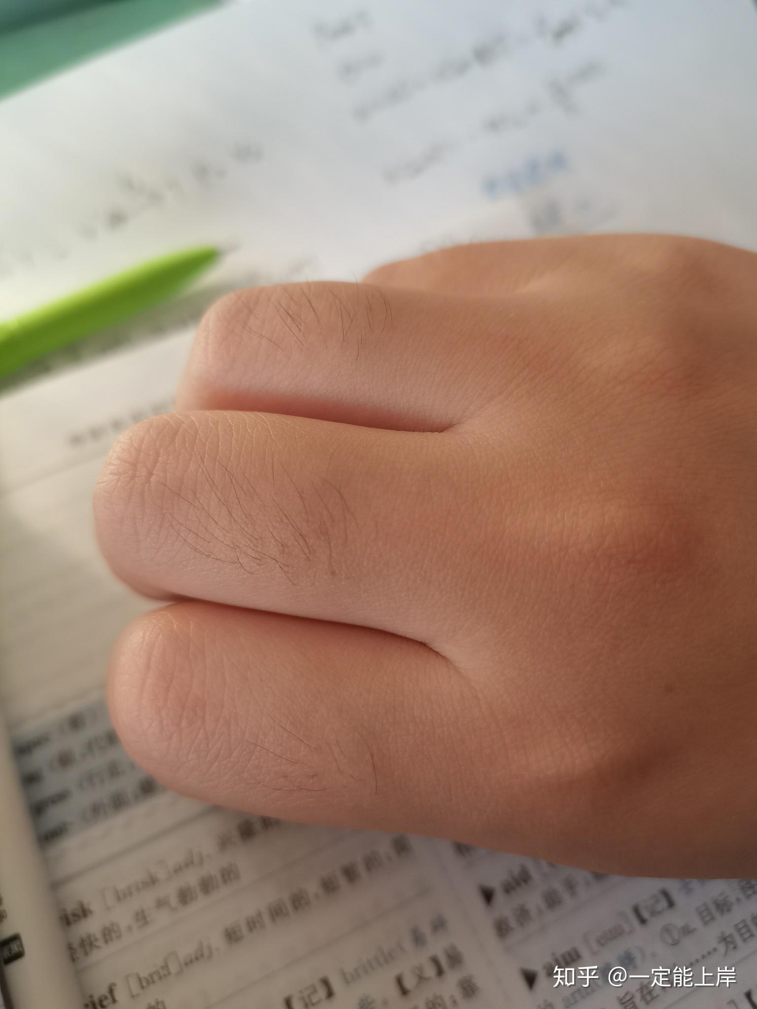 我是女生,手背上汗毛很多,毛孔特别大,密密麻麻的,大家有紧毛孔的办法