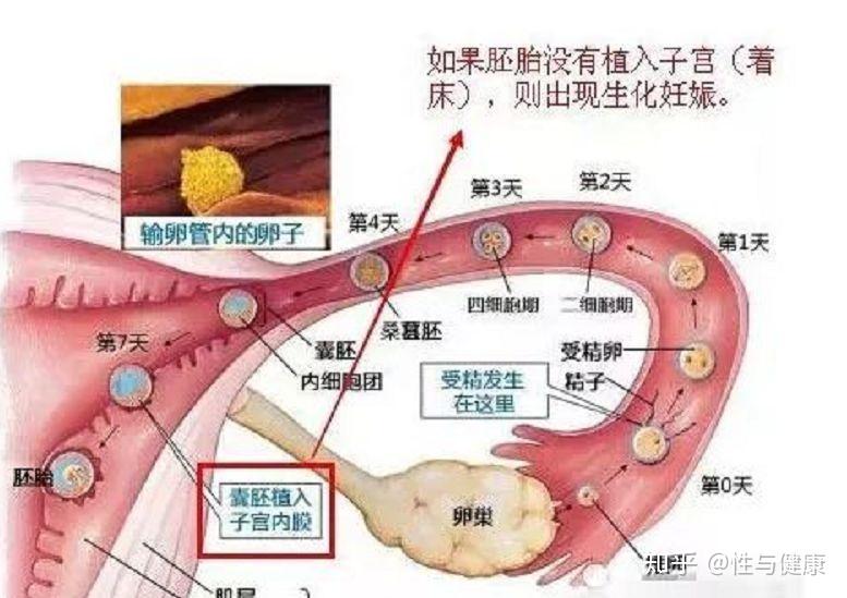 生化妊娠是指因为在受精卵形成之初,就能分泌特异的人绒毛促性腺激素