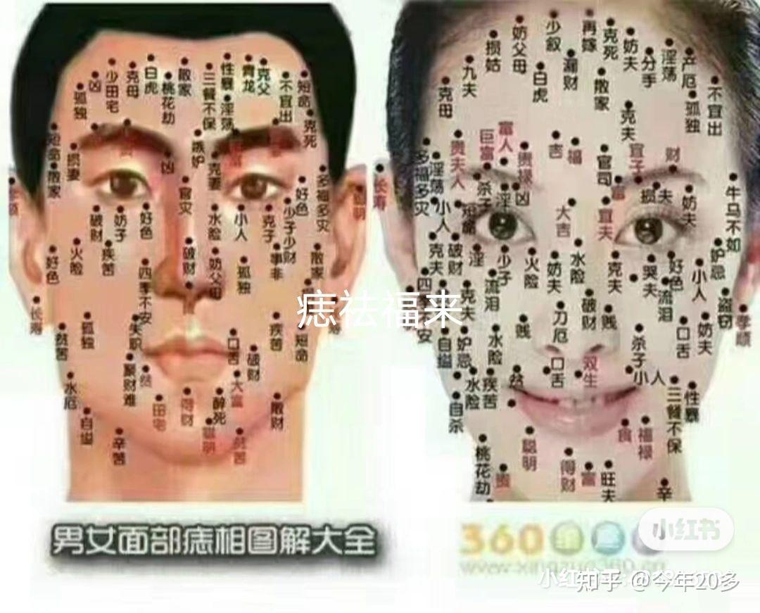 方法,用牙签或其他器具蘸取少量药膏点在痣上,不要涂在正常皮肤部位