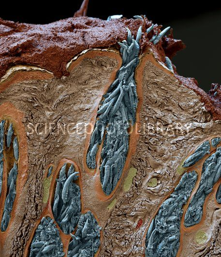 水氧治疗可以冲洗出毛囊虫吗?