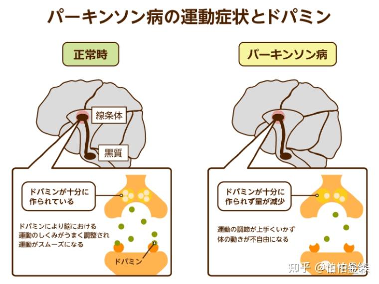  3. うつ病と不安症