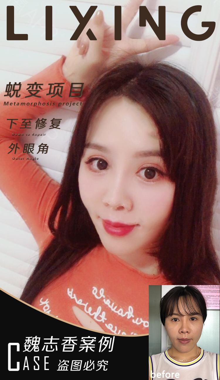 v2-715b797107f392bc0200e2ca943cc14d_1440w.jpg?source=172ae18b