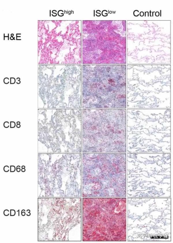 amp;e,cd3,cd8,cd68,cd163免疫組化染色