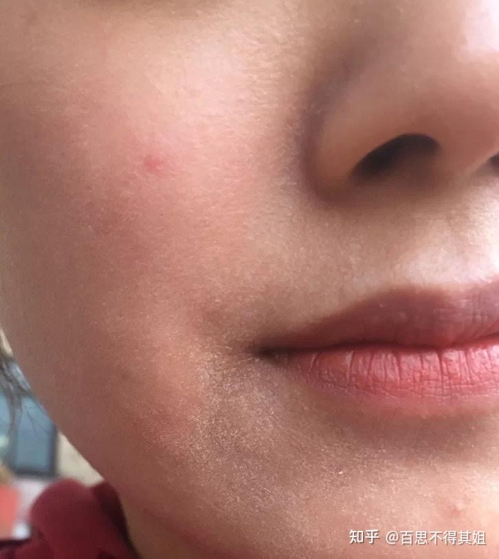 皮肤缺水怎么补水