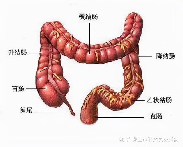 发现低位直肠癌,肿瘤位于直肠前壁齿状线上方2cm,病变就在肛门口