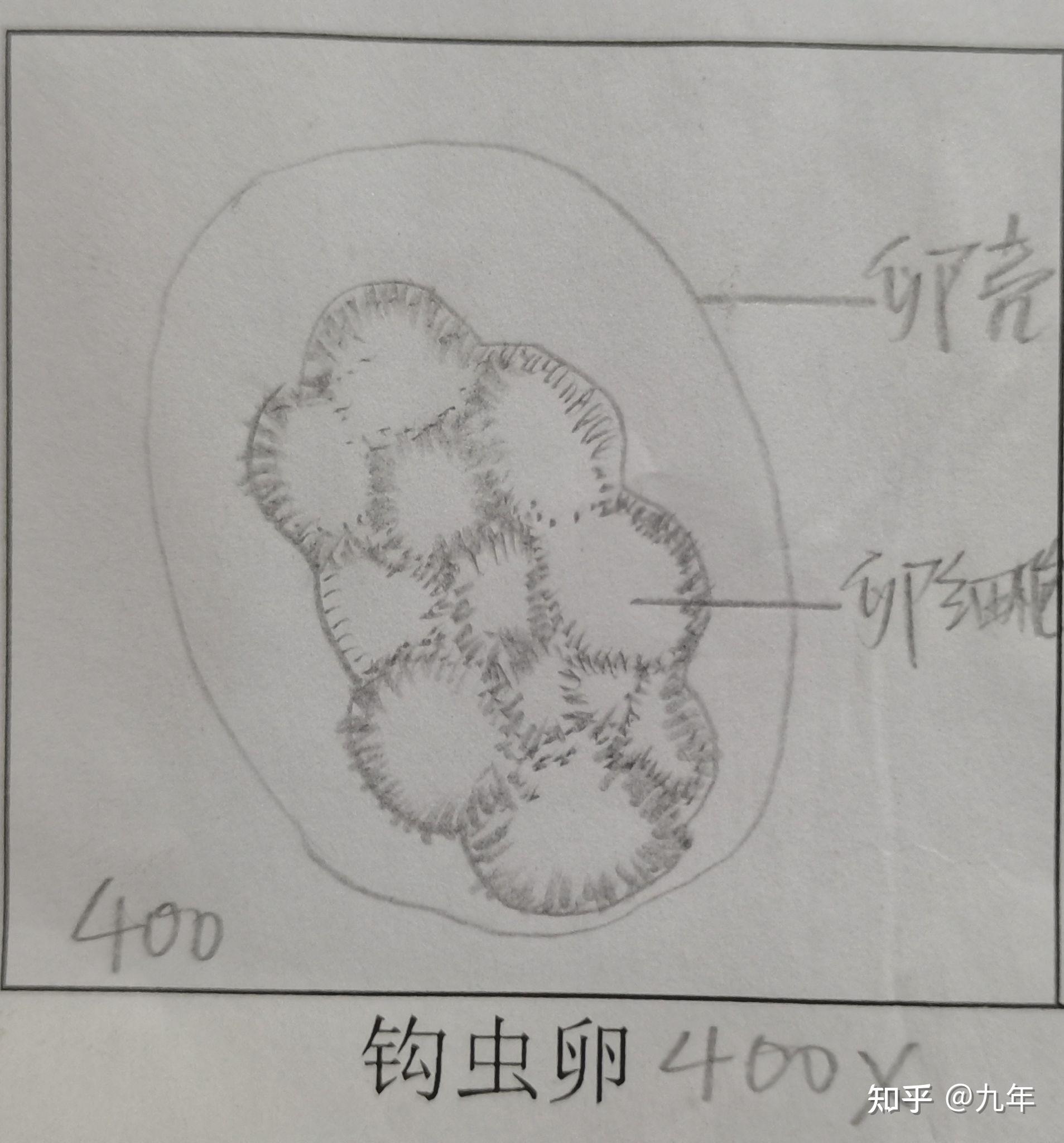 肝吸虫卵结构图图片