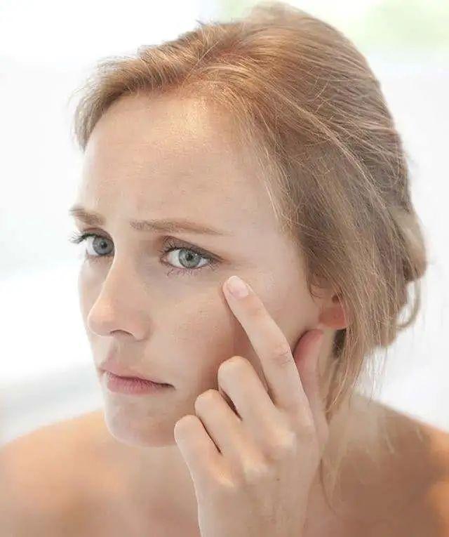 这是干纹还是细纹