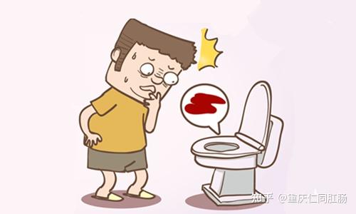 便血是痔疮犯了,还是肛门裂了? - 知乎