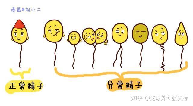男性精子畸形率高应该怎么办? - 知乎