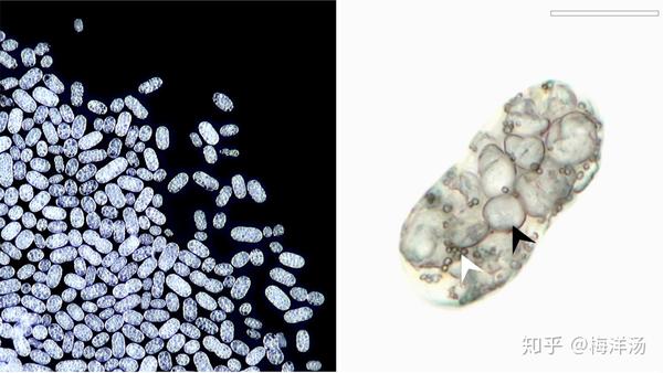 “重度结石细菌”——小石子细菌Achromatium(2)