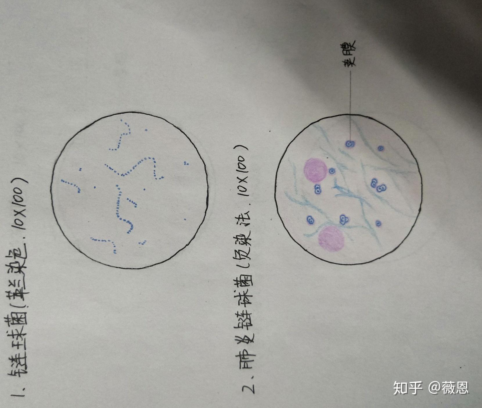 化脓性球菌手绘图图片